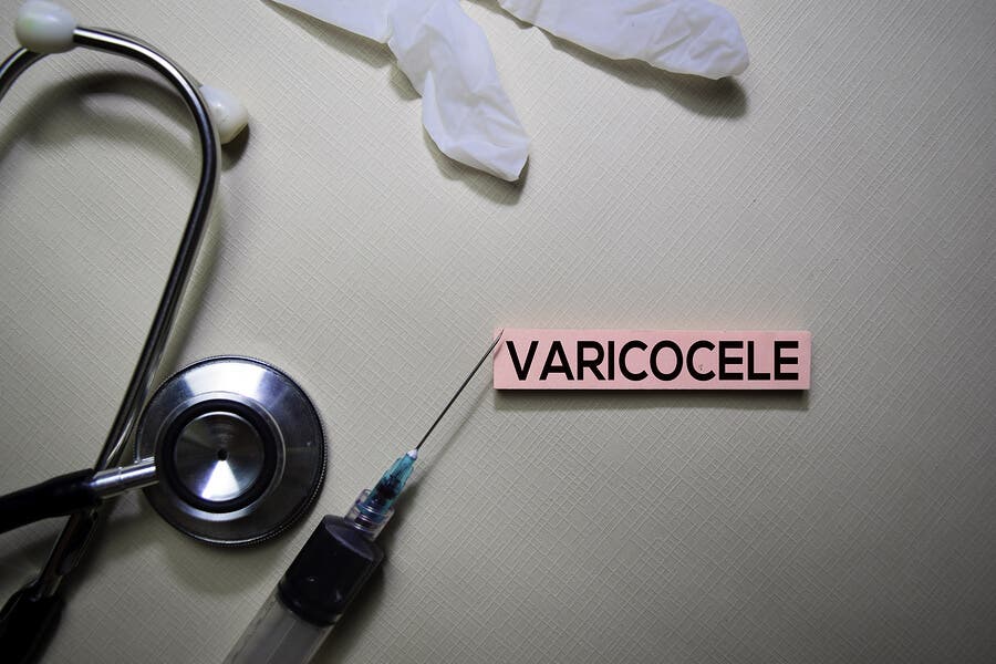 Varicocele