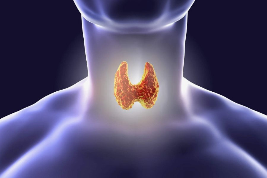 Parathyroidectomy