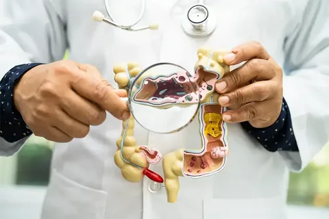 Pilonidal Sinus